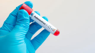 Dấu hiệu cảnh báo viêm gan bí ẩn ở trẻ