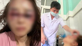 Người phụ nữ tố nhân tình đánh mình bầm dập sau khi hát karaoke