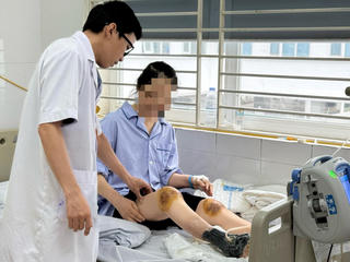 Cho ong đốt để chữa bệnh, người phụ nữ bị hoại tử chân