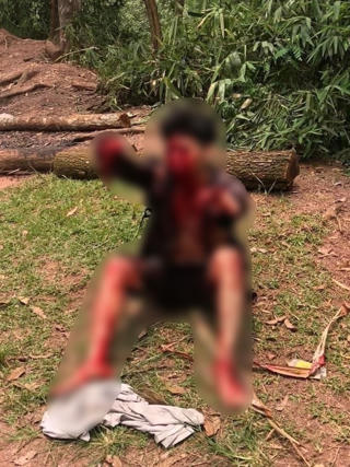 Quảng Ninh: Kích nổ mìn tự chế để đánh cá, 1 người thương nặng