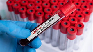 Đại dịch Covid-19 đã đến chặng cuối?