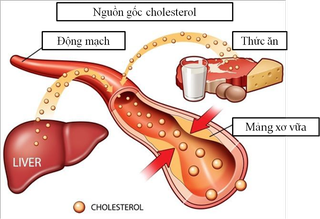 Y học cổ truyền trong điều trị rối loạn lipid máu