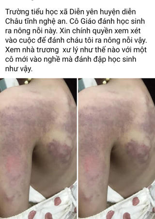 Nghi vấn cô giáo đánh học sinh lớp 3 do không thuộc bài