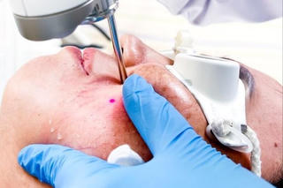 “Tiền mất, tật mang” từ mỹ phẩm chứa corticoid