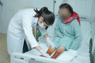 Hoại tử hai bàn chân vì dùng thuốc ngâm không rõ nguồn gốc