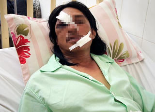 Cảnh sát 113 tước súng côn đồ trước phòng cấp cứu