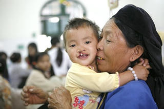 Phẫu thuật miễn phí cho trẻ em bị dị tật hở hàm ếch