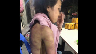 Vụ bé gái 12 tuổi bị mẹ đẻ bạo hành dã man: Đủ dấu hiệu phạm tội, phải khởi tố