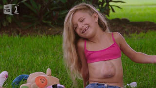 Bé gái có trái tim nằm ngoài lồng ngực