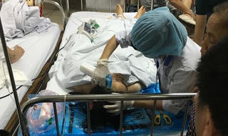 Chồng chém vợ dã man