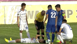 Chấn thương nặng, sao HAGL lỡ hẹn đại chiến với Hà Nội FC