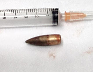 Đốt rác, một người thanh niên bị viên đạn "găm" trúng tim