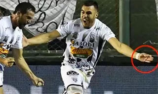 Cầu thủ Argentina dùng kim khâu chích đối thủ giữa trận đấu