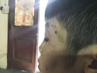 [ẢNH] Những vết thương chằng chịt trên người cậu bé bị bạo hành