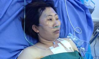 Cứu sống người bệnh vỡ tim