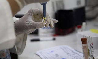 Mỹ áp dụng phương pháp xét nghiệm virus Zika mới