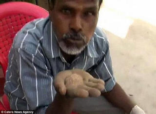 Người đàn ông ăn… cát suốt 25 năm