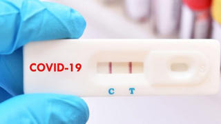 Từ 21/2, giá dịch vụ xét nghiệm Covid-19 nhanh tối đa 78.000 đồng/xét nghiệm