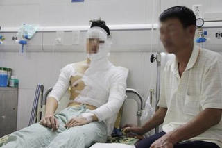 Vụ một sinh viên trường ĐH Sân khấu điện ảnh bị tạt axit: Nguyên nhân do ghen tuông tình ái