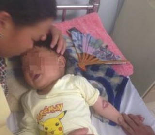 Ăn nhầm hóa chất, bé trai bị bỏng miệng và thực quản dạ dày