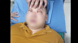 Thái 1 củ hành, nam thanh niên 25 tuổi bị sốc phản vệ, khó thở