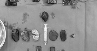 Hy hữu: Người đàn ông ăn 'tất cả mọi thứ'