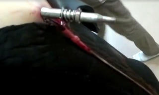 Thoát chết thần kỳ dù bị súng bắn lao xuyên cổ