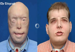 Ghép toàn bộ gương mặt