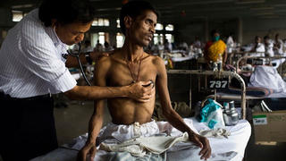 Những bệnh dịch gây chết người nhiều nhất trong lịch sử