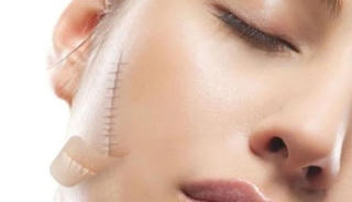 Vì sao phải cân nhắc khi đi làm đẹp ở thẩm mỹ viện