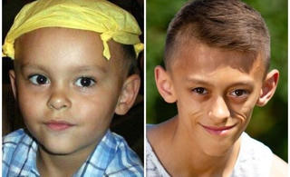 Căn bệnh lạ biến cậu bé 11 tuổi thành ông già 70 tuổi