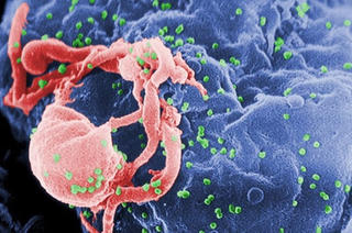 Sống chung với HIV 12 năm không dùng thuốc