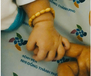 Bệnh nhân 14 tháng tuổi nhiễm Covid-19: Sức khoẻ ổn định, ăn ngoan. 