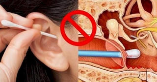 Đừng 'chết’ vì ngoáy tai