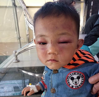 Tạm giữ người đánh vào đầu con riêng của vợ