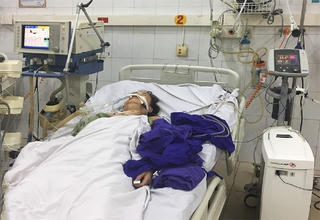 Bệnh nhân sống lại sau 4 lần ngừng tim