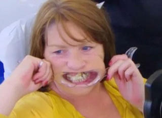 10 năm gắn răng vào lợi bằng keo vì sợ đi nha sĩ