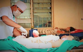 Nổ hóa chất lạ, thiếu niên 15 tuổi phải cắt bỏ 2 bàn tay
