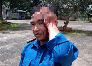 2 người bị chém khi tham gia đoàn giải tỏa đất rừng lấn chiếm