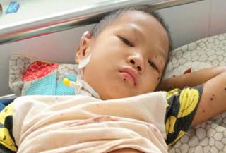 Chơi với kíp nổ, bé trai 8 tuổi trọng thương