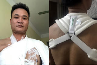 Hải Dương: Vô cớ đánh người rồi trốn tránh trách nhiệm
