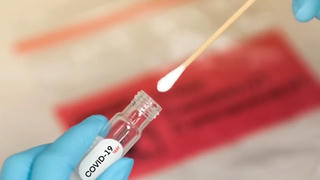 Tiếp xúc F0 nhưng không mắc Covid-19