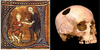 Những phương pháp điều trị y học cổ xưa mãi mãi lưu lại trong quá khứ