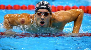 Michael Phelps giành huy chương vàng Olympic nhờ… giác hơi