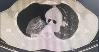 Nguyên nhân bất ngờ khiến người đàn ông đang chơi thể thao phải đi cấp cứu