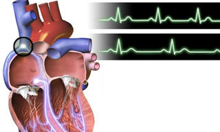 Nhịp tim chậm không làm tăng nguy cơ bị bệnh tim mạch