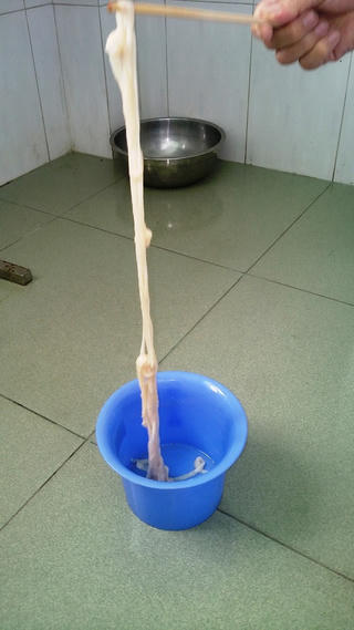 [KINH HOÀNG] Sán xơ mít dài 10m được xổ ra thành công