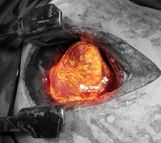 Cứu sống một phụ nữ bị kẻ gian đột nhập đâm thấu tim, gan