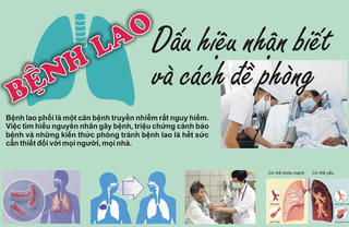 Không chủ quan với bệnh lao