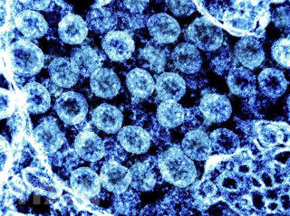 Phát hiện mới về khả năng lây lan của virus SARS-CoV-2